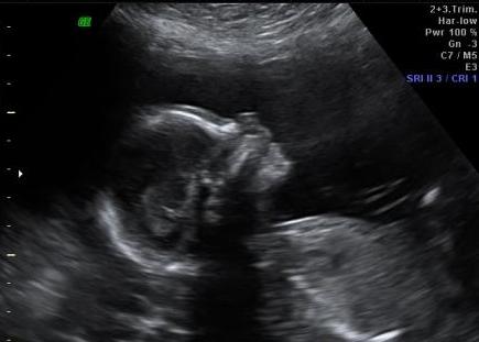 Little Baby Boy Beck